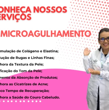 Imagem Microagulhamento